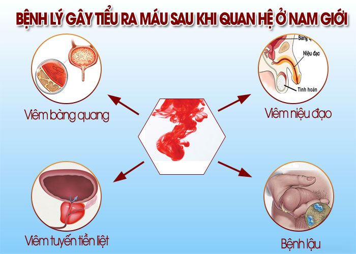 đi tiểu ra máu sau khi quan hệ ở nam