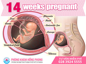 Thai 14 tuần có phá được không? Tư vấn cách phá thai 14 tuần