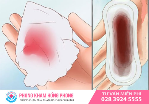 Cách làm sẩy thai tự nhiên tại phòng khám Hồng Phong