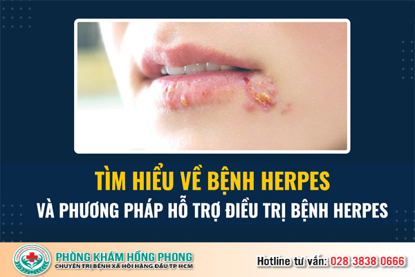 Herpes là gì? Cách điều trị hiệu quả